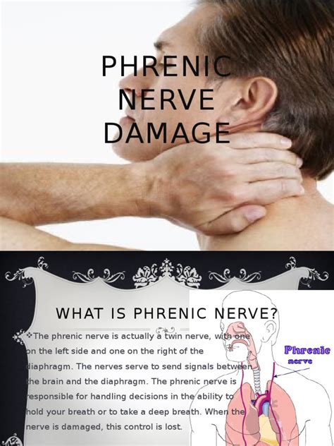 Paralysis of the <b>phrenic</b> <b>nerve</b> can be on one or both sides. . Symptoms of phrenic nerve damage